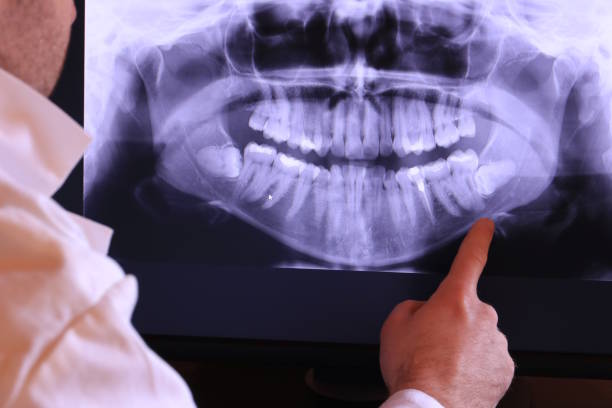 Best Emergency Broken Tooth Repair in Marshalltown, IA