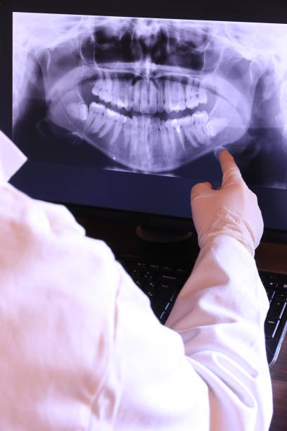 Best Emergency Broken Tooth Repair in Marshalltown, IA