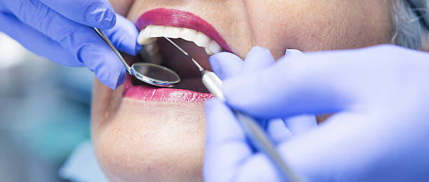 Best Emergency Dental Surgery in Marshalltown, IA